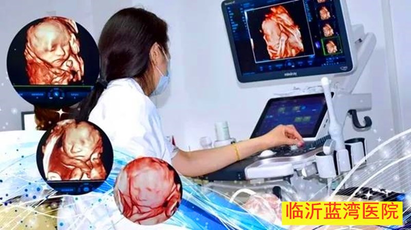 操作五维彩超.jpg