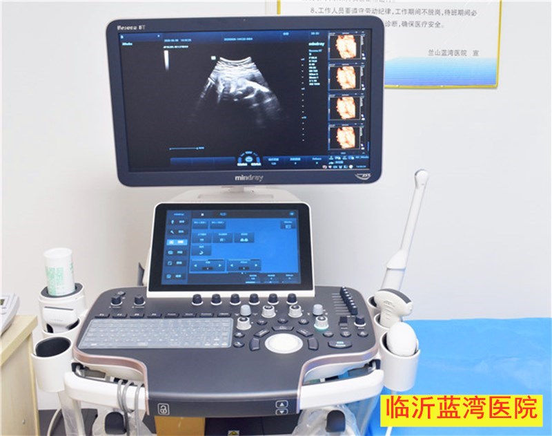 五维立体彩超仪器2.jpg