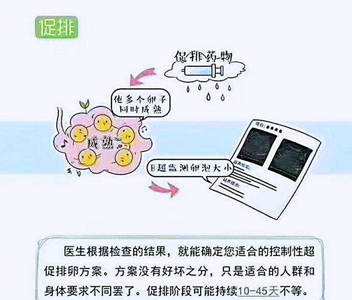 促排卵5.jpg